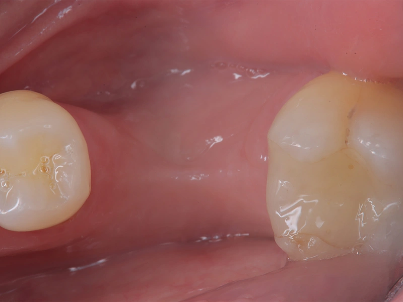 Before Image