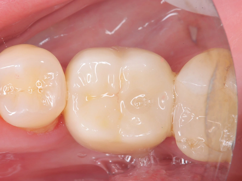After Image