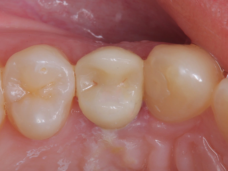 After Image