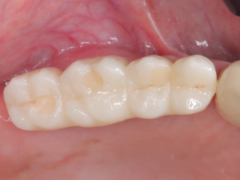 After Image