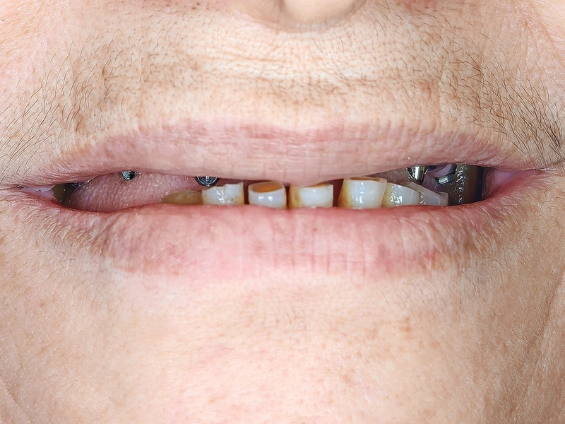 Before Image