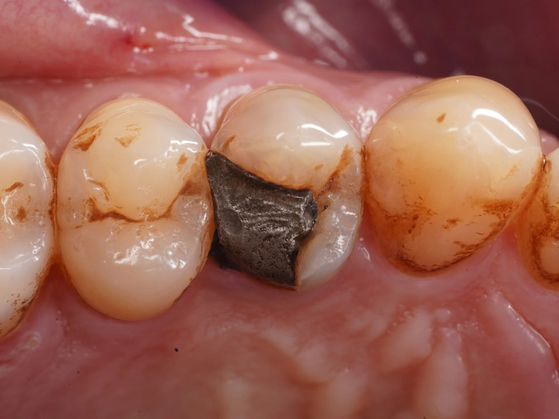 Before Image
