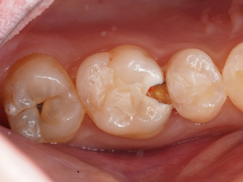 Before Image