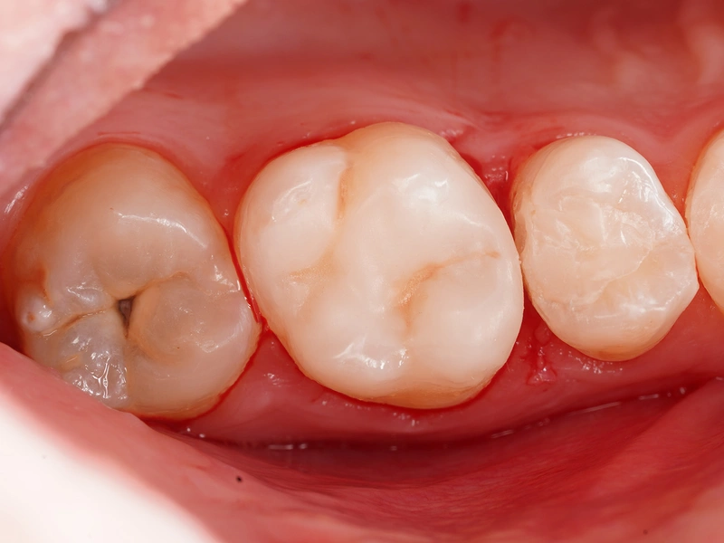 After Image