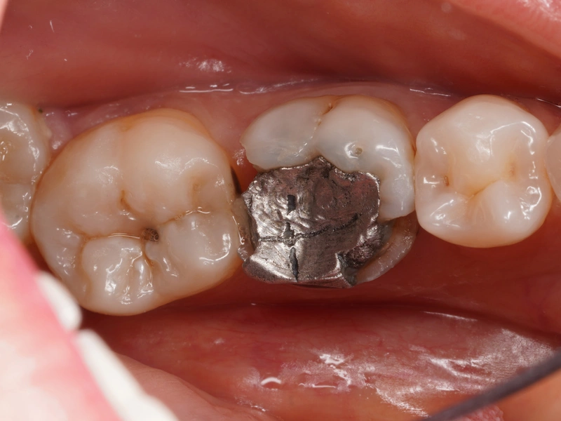 Before Image