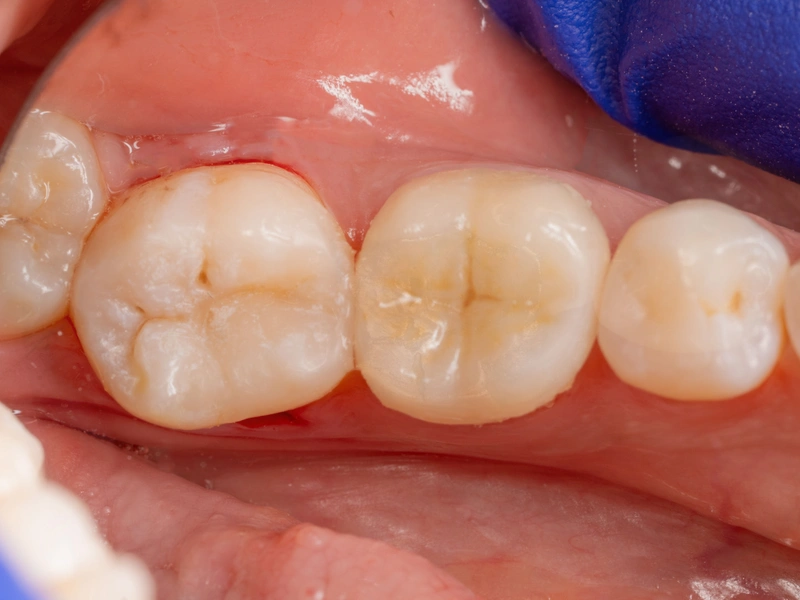 After Image
