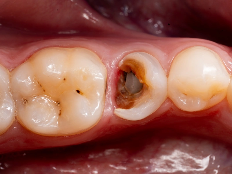 Before Image