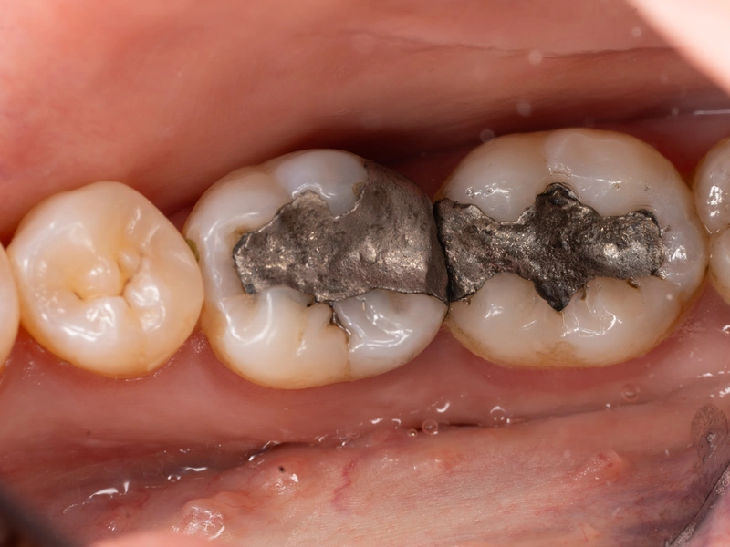 Before Image