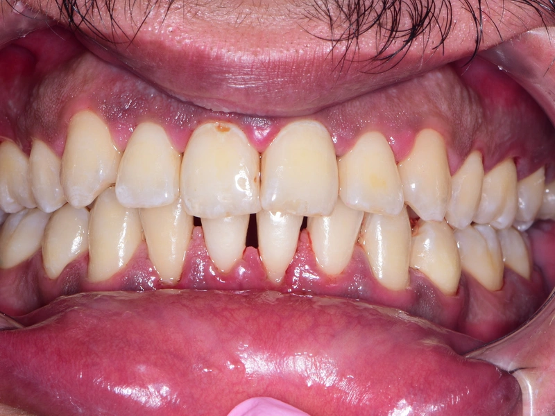After Image