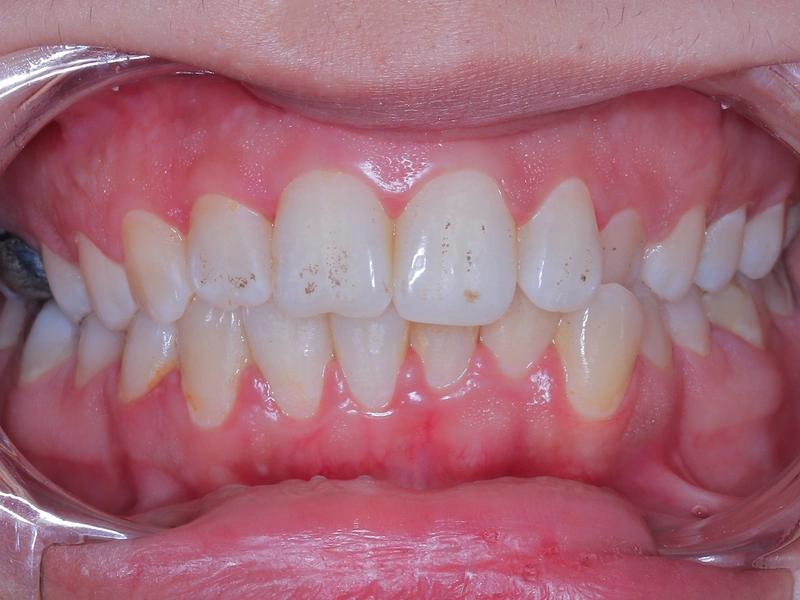 Before Image