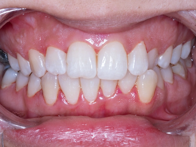 After Image