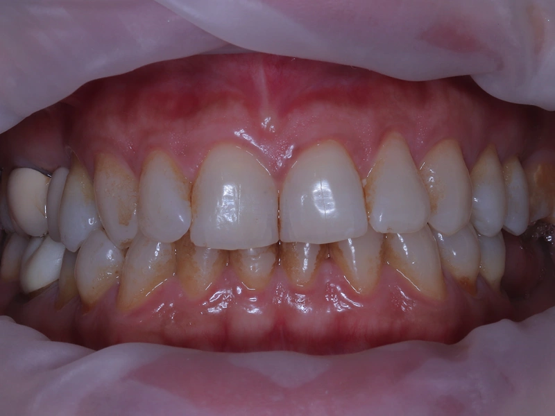 Before Image