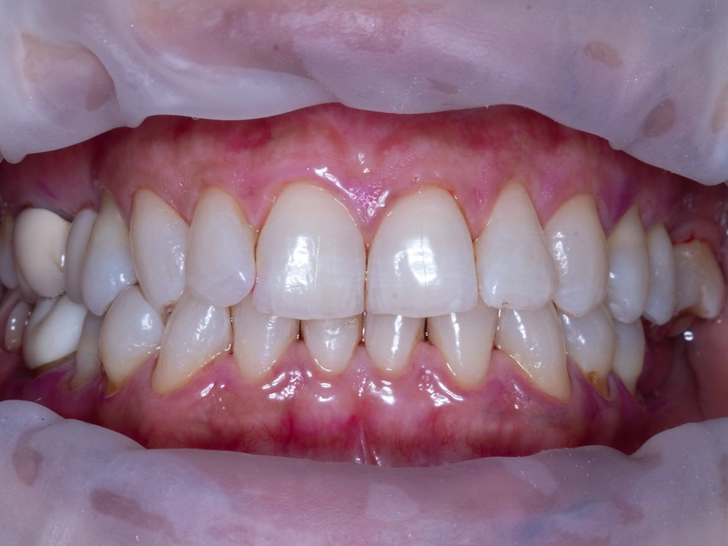 After Image
