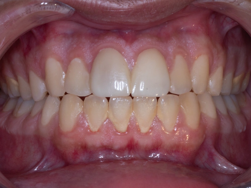 Before Image
