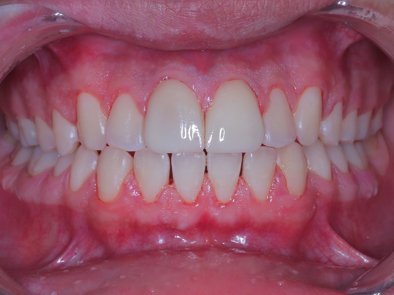 After Image