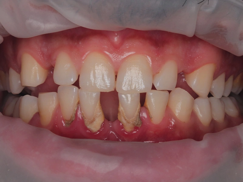 Before Image