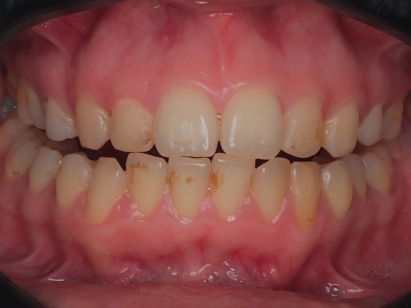 Before Image