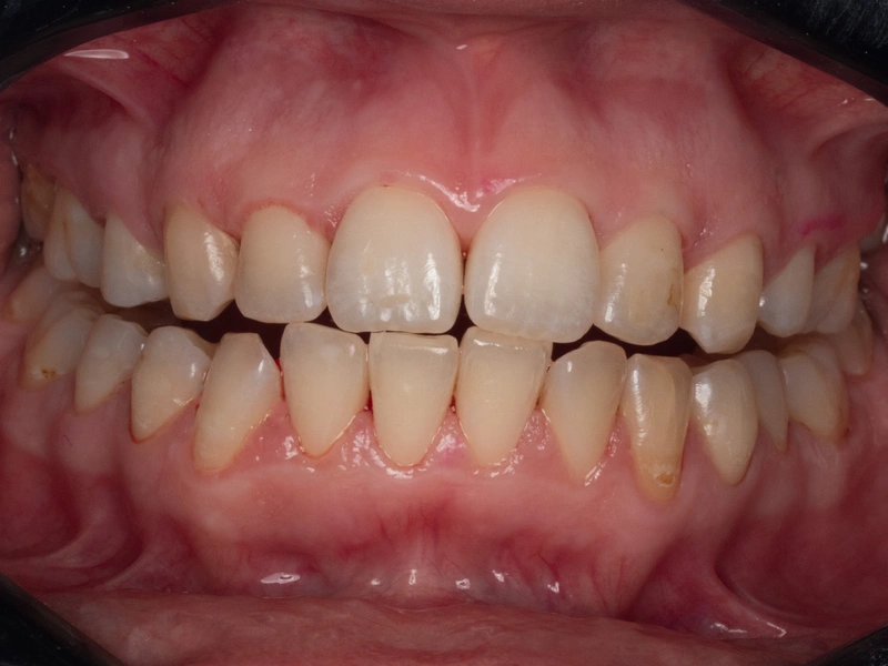 After Image
