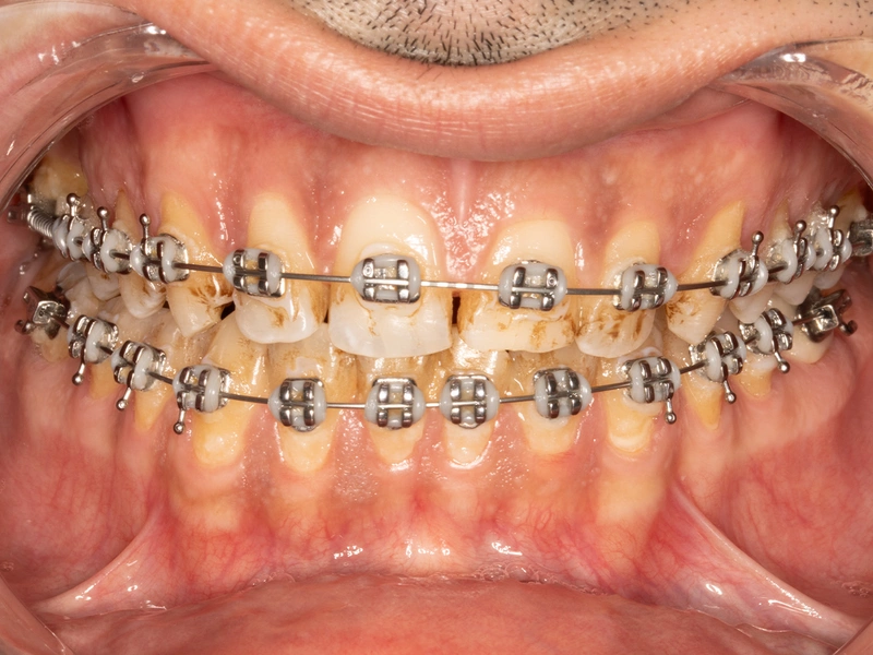 Before Image