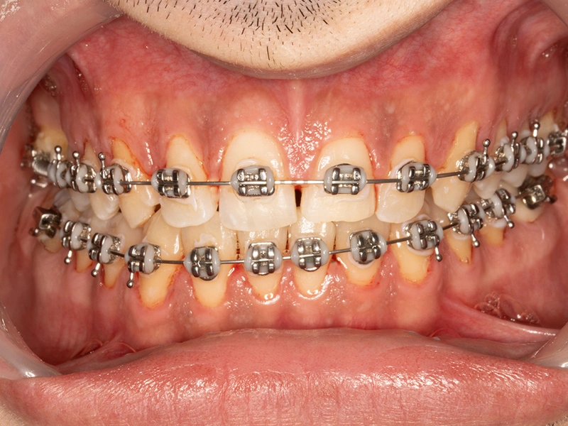 After Image