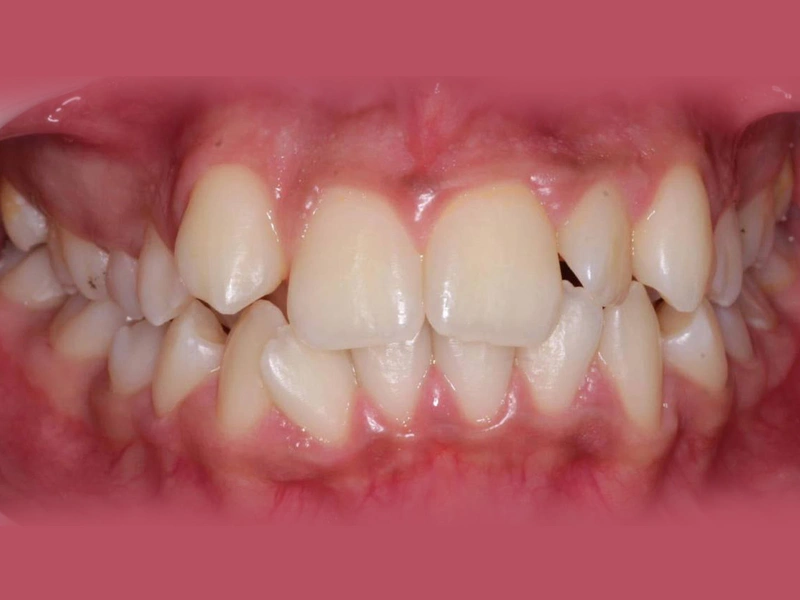 Before Image