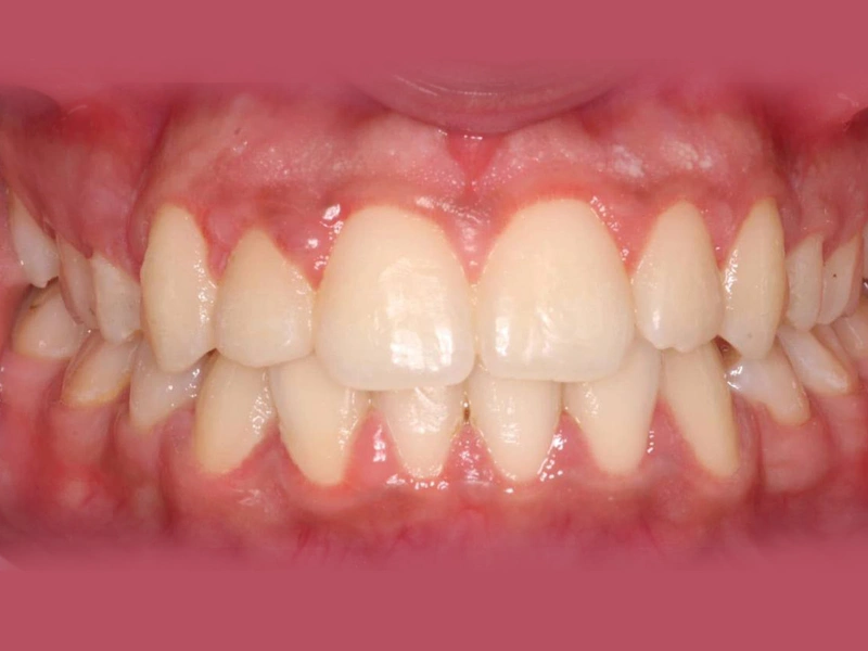After Image