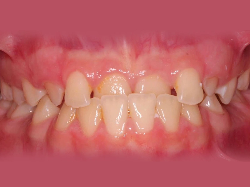 Before Image
