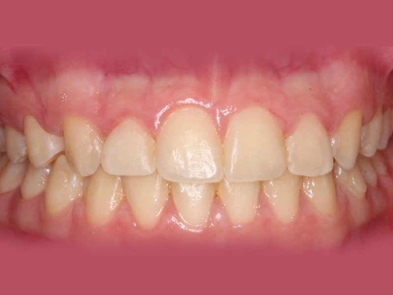 After Image