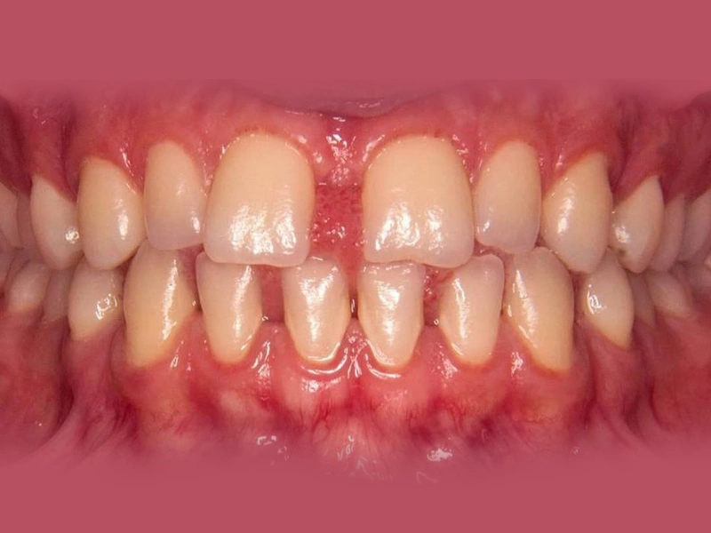 Before Image
