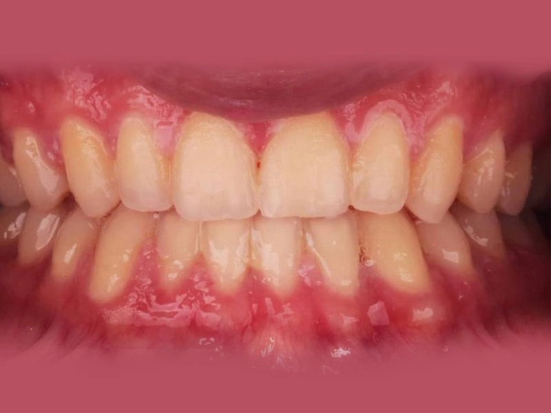 After Image