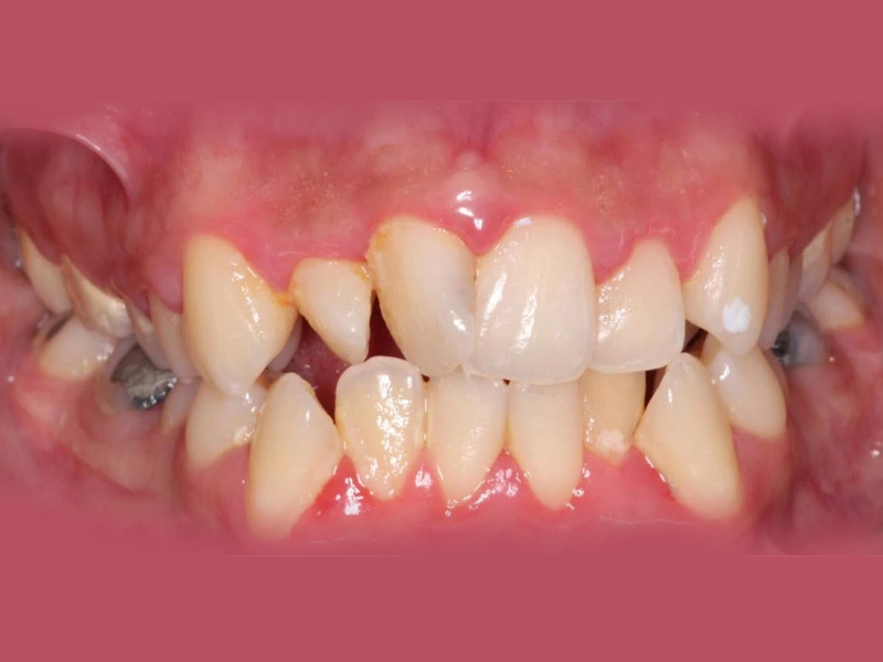 Before Image