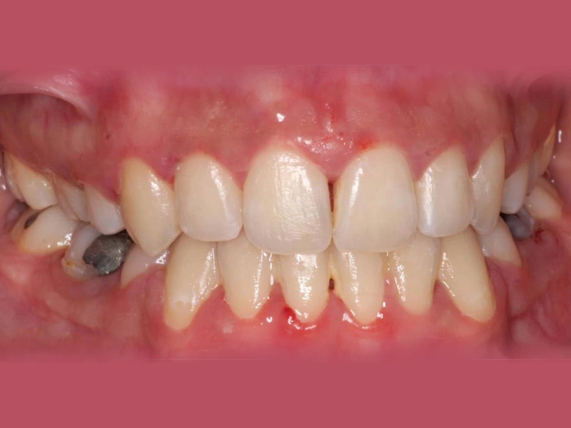 After Image