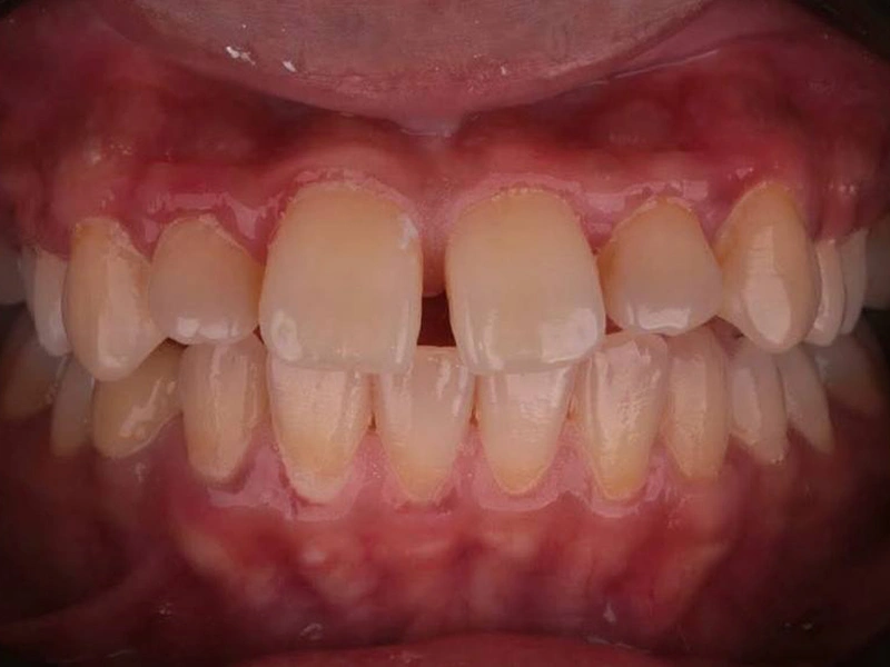 Before Image