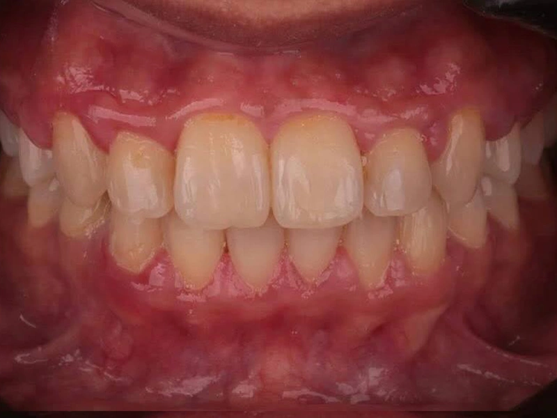 After Image