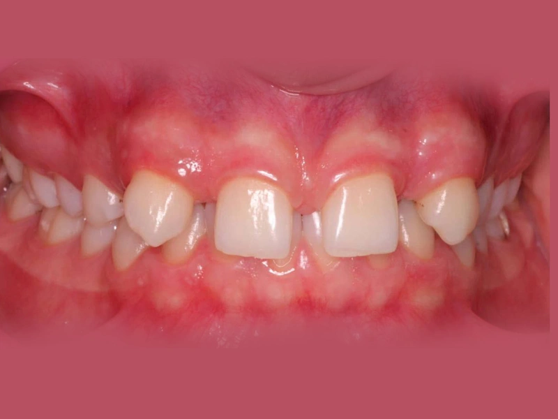 Before Image