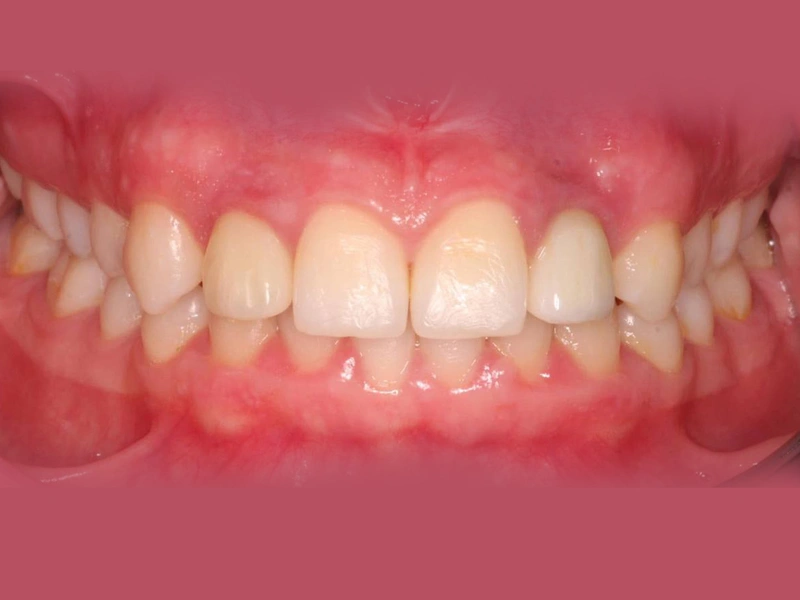 After Image