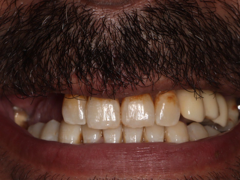 Before Image