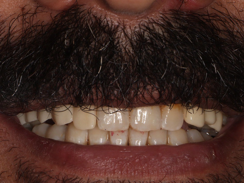 After Image