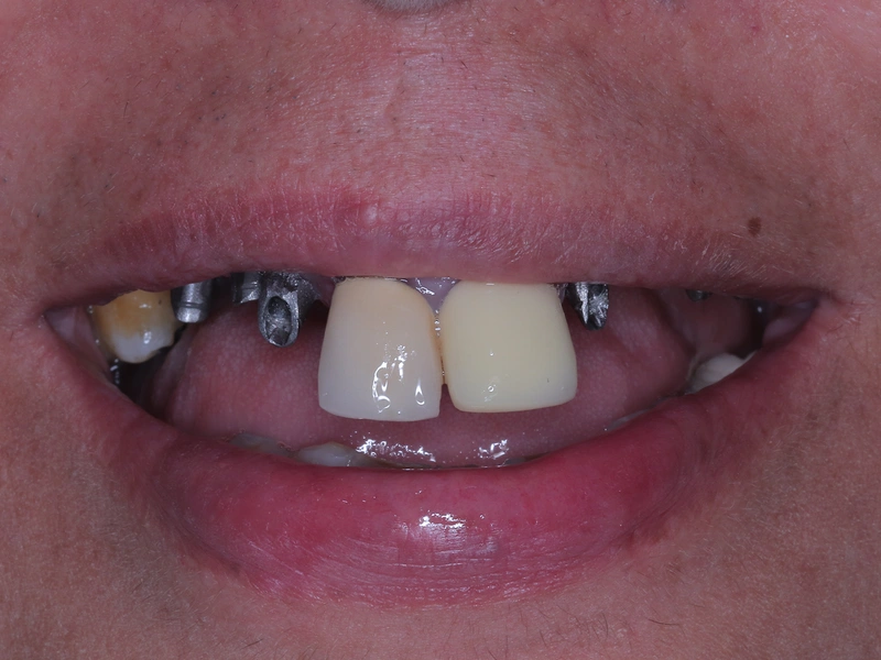 Before Image