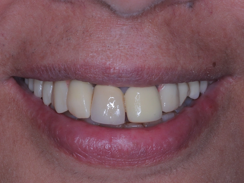 After Image
