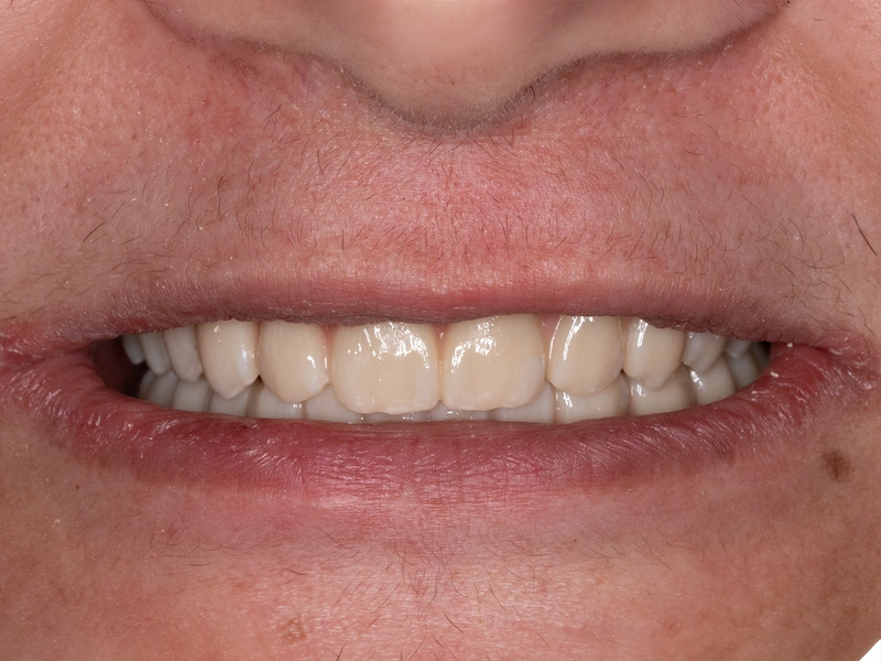 After Image