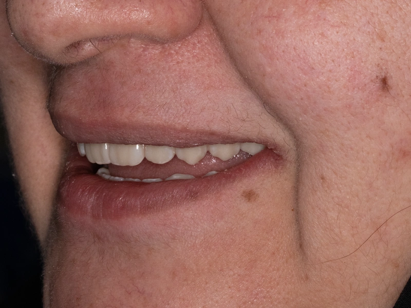 After Image