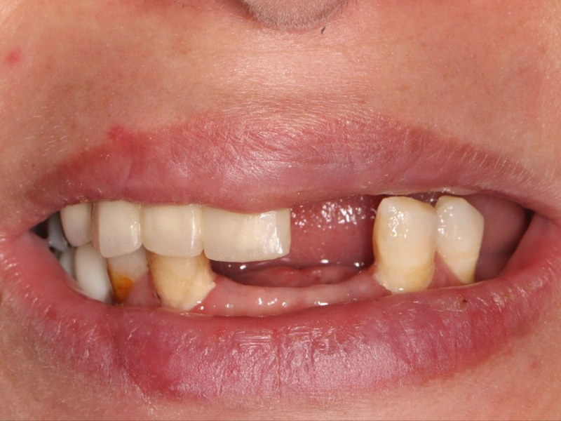 Before Image
