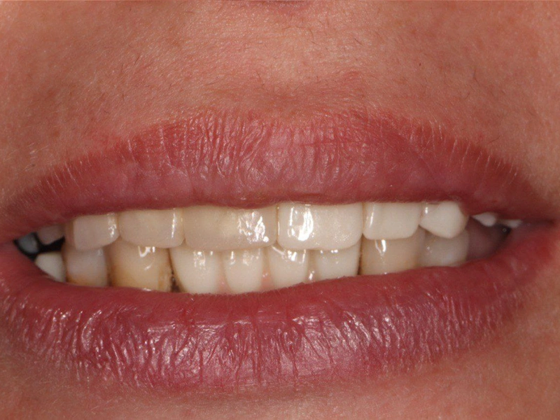 After Image