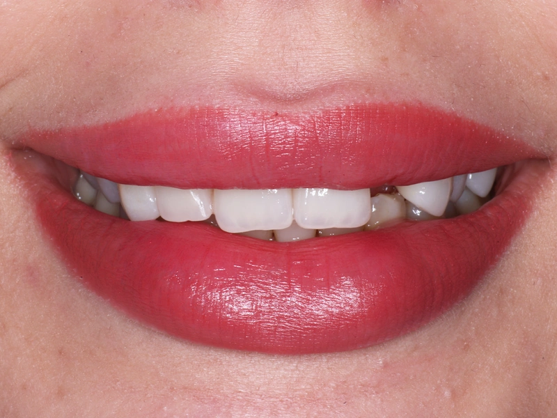 Before Image