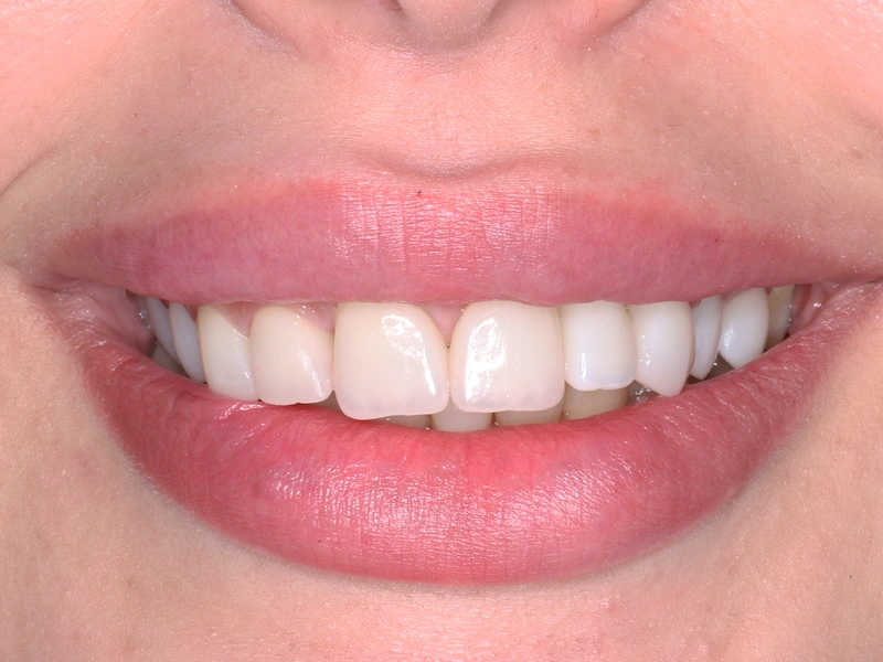 After Image