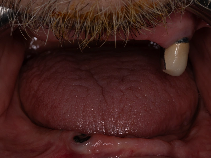 Before Image