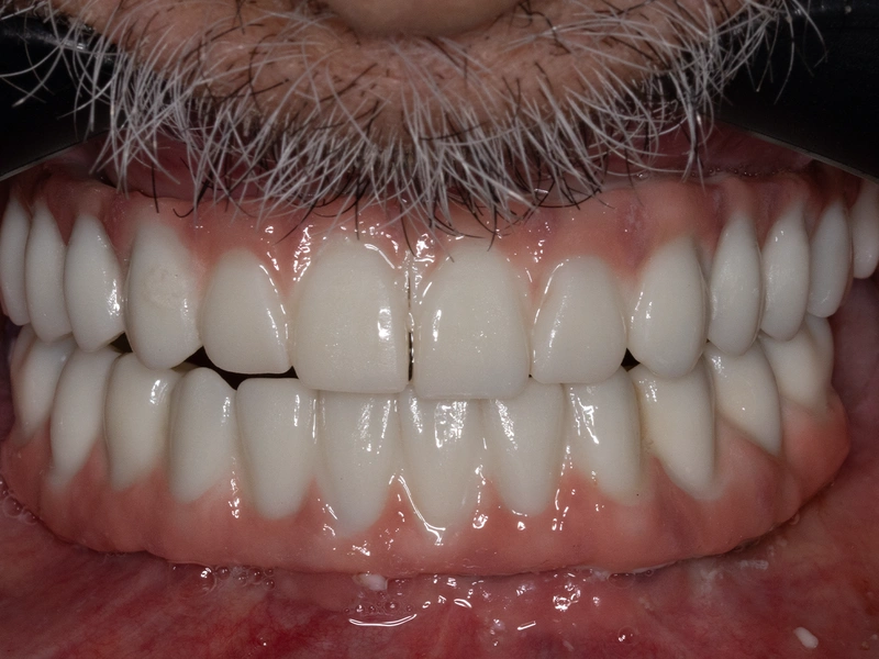After Image