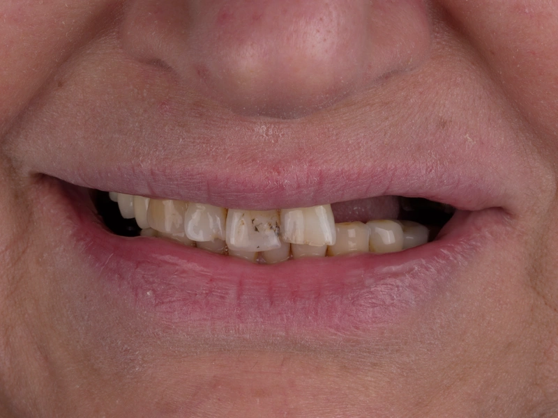 Before Image