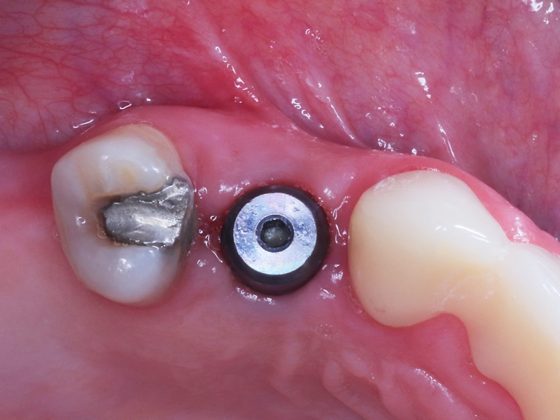 Before Image